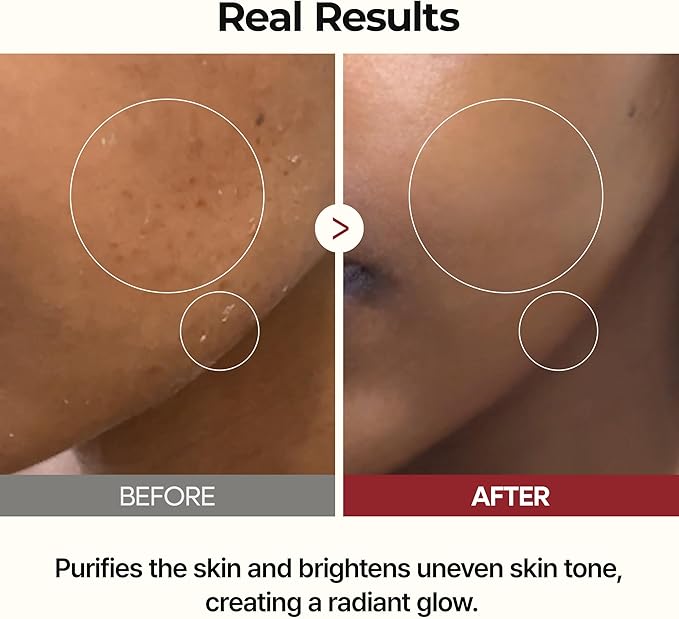 Peel Shot Glow Rice Tonic 200 ml detail view 5 — Melax K-Beauty