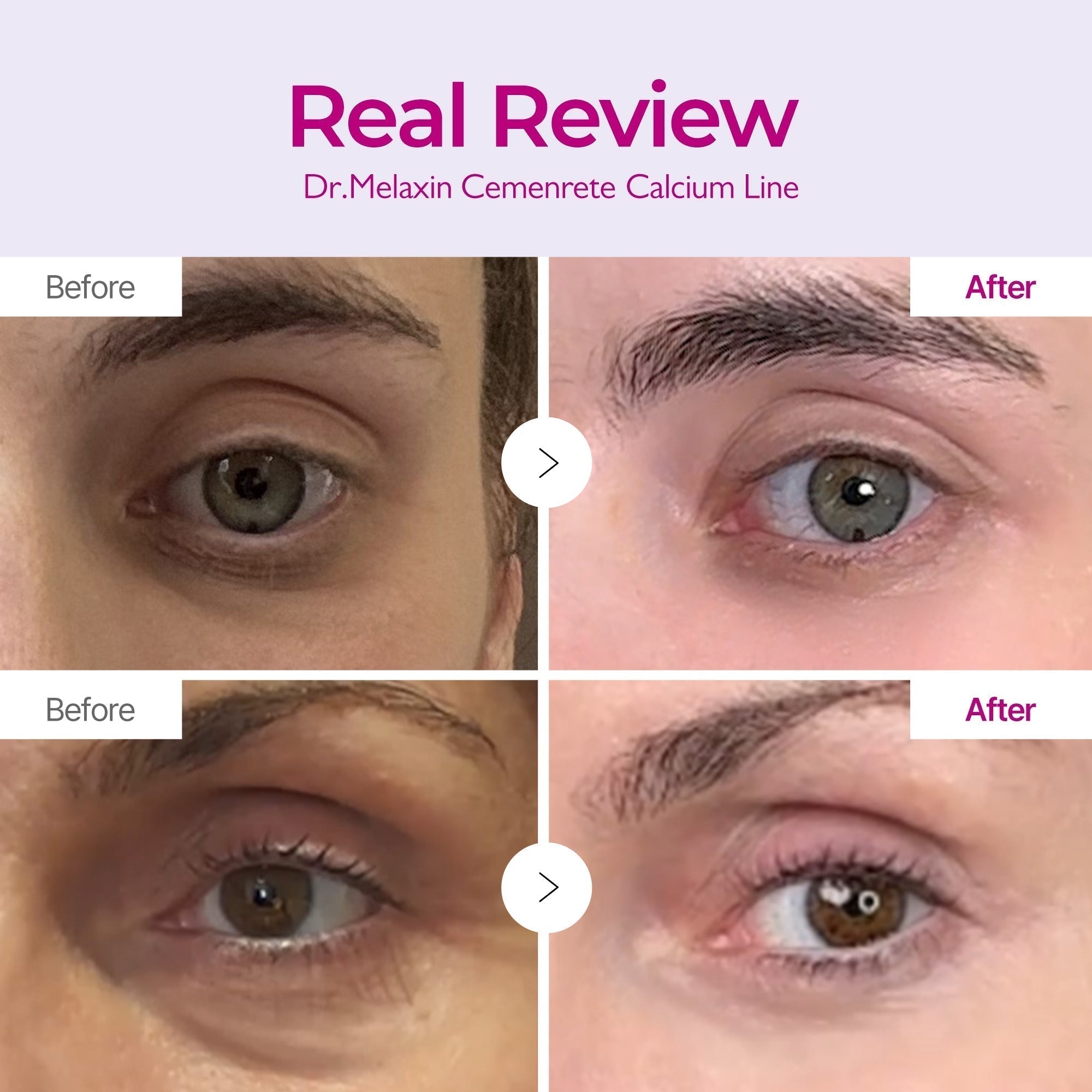Cemenrete Calcium Eyecare Routine detail view 4 — Melax K-Beauty