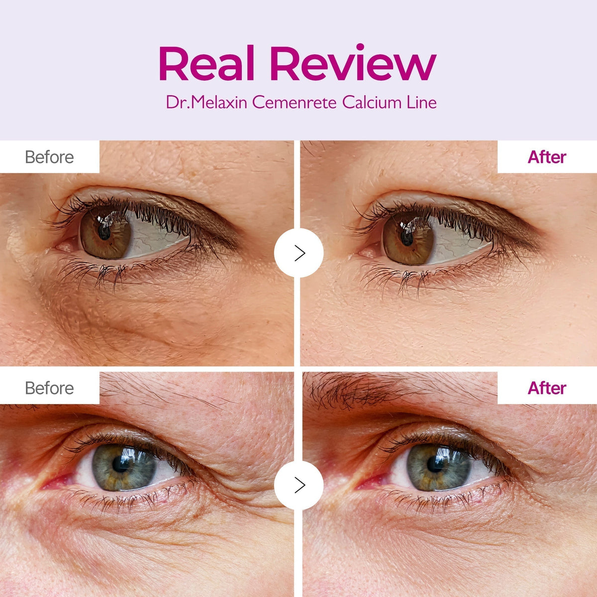 Cemenrete Calcium Volume Eye patch 60ea detail view 4 — Melax K-Beauty