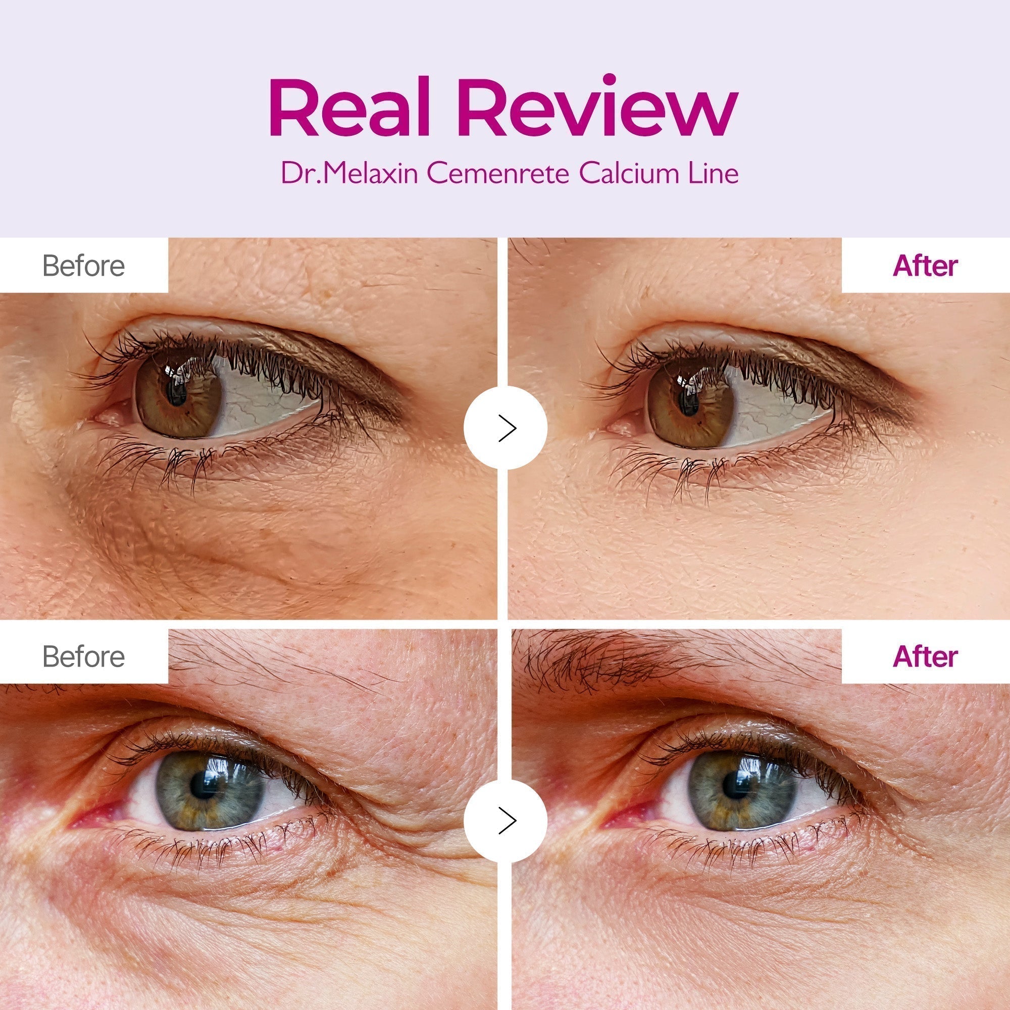 Melax Eye Care Complete Routine detail view 3 — Melax K-Beauty