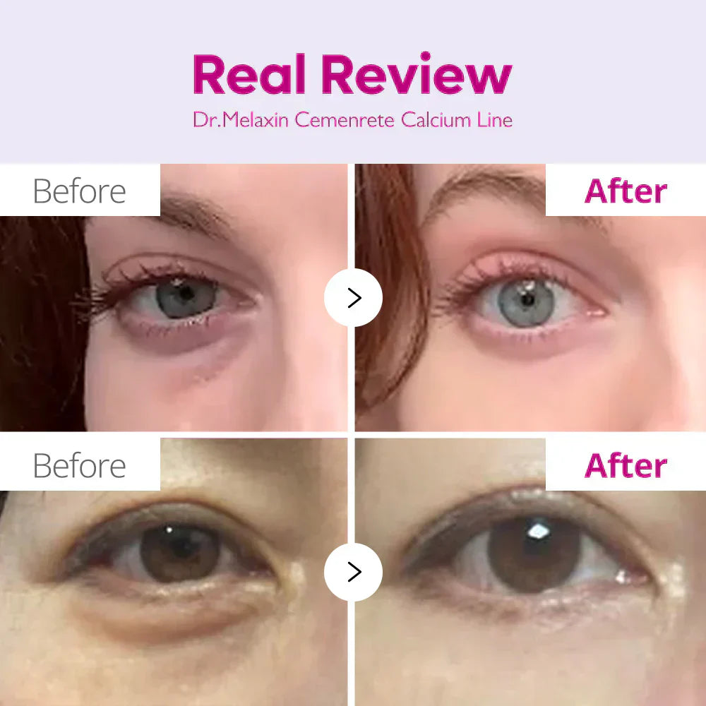 Cemenrete Eye care Line detail view 4 — Melax K-Beauty