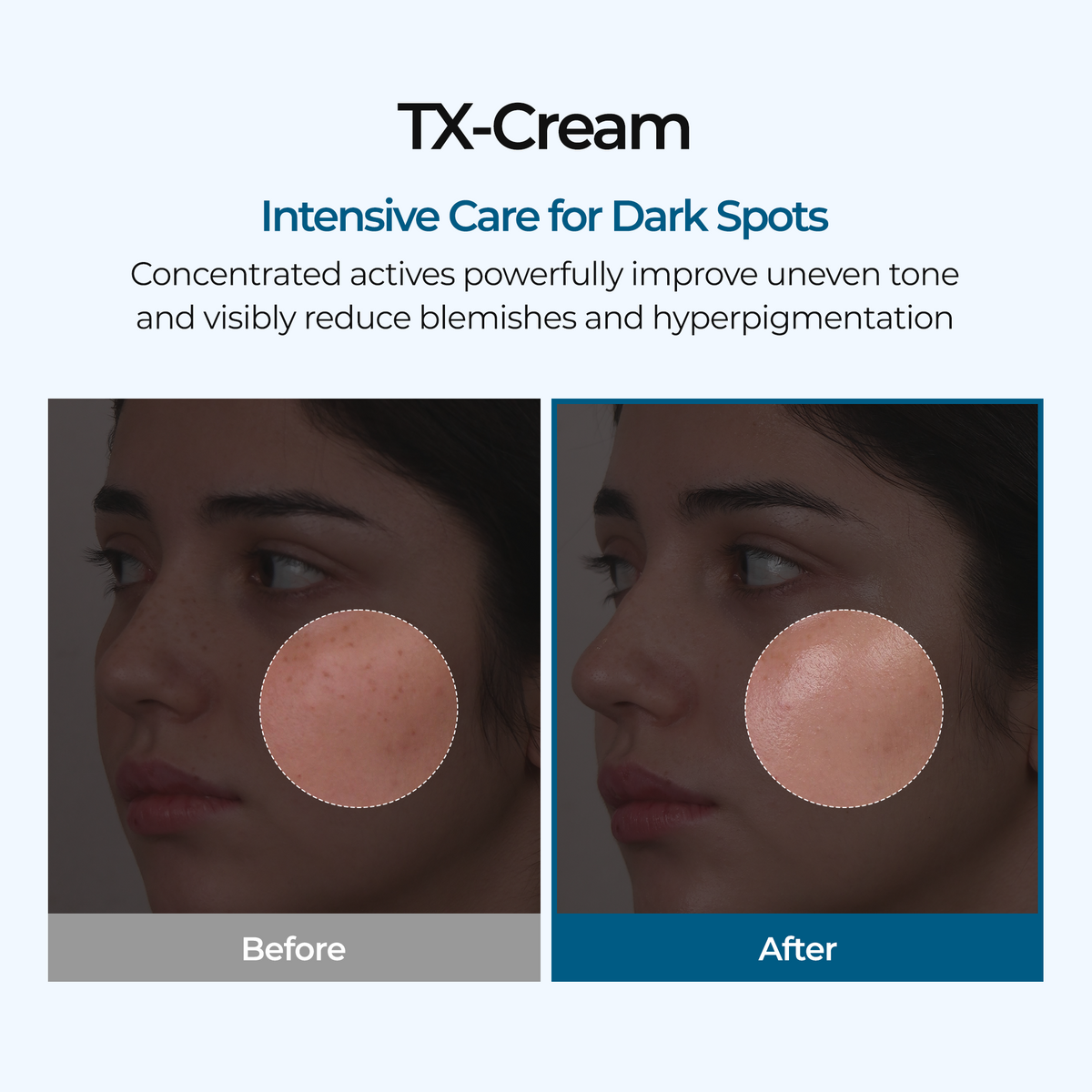 TX Cream detail view 4 — Melax K-Beauty
