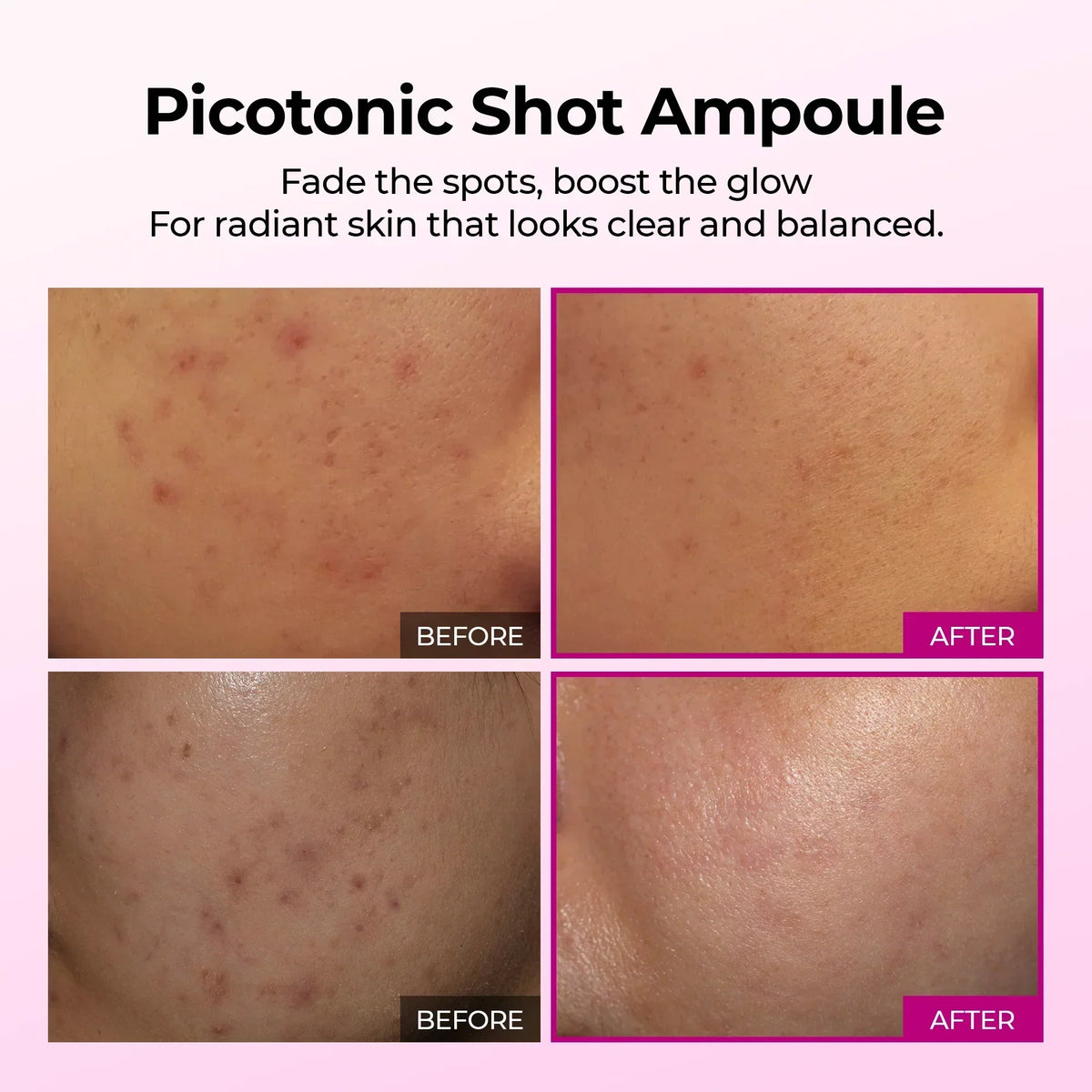 Picotonic Shot Pigmentation Ampoule detail view 5 — Melax K-Beauty