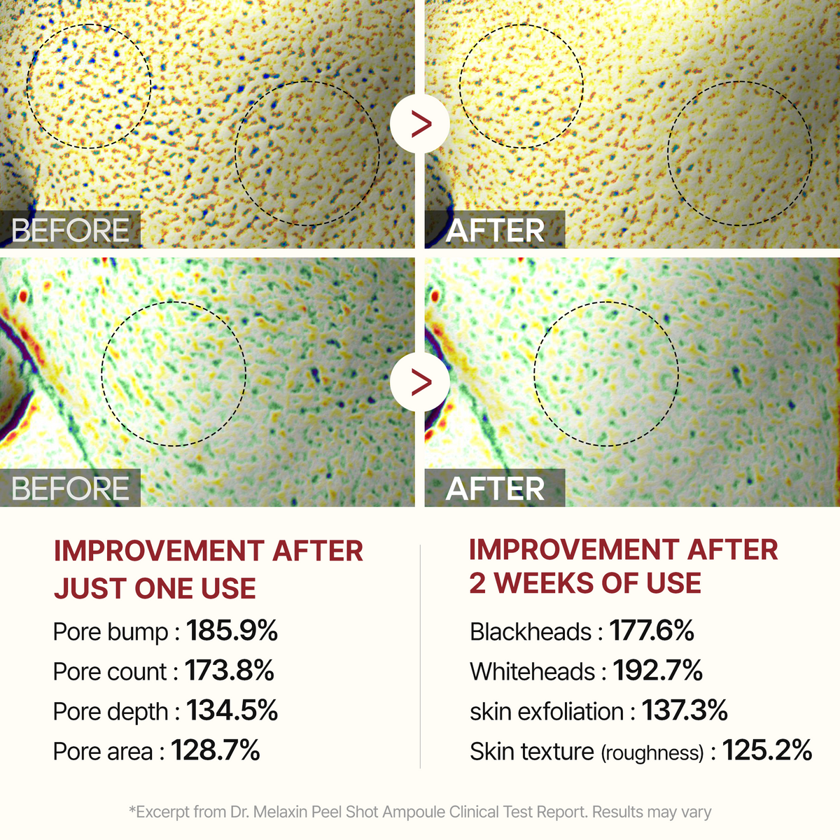 Peel Shot Trio Complete detail view 6 — Melax K-Beauty