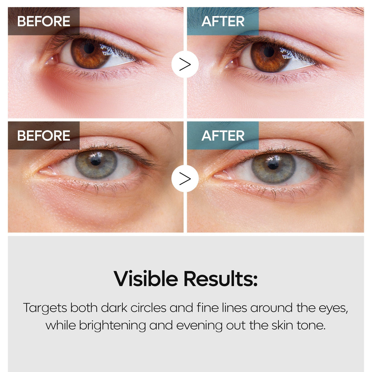 TX Eye Care Trio detail view 5 — Melax K-Beauty