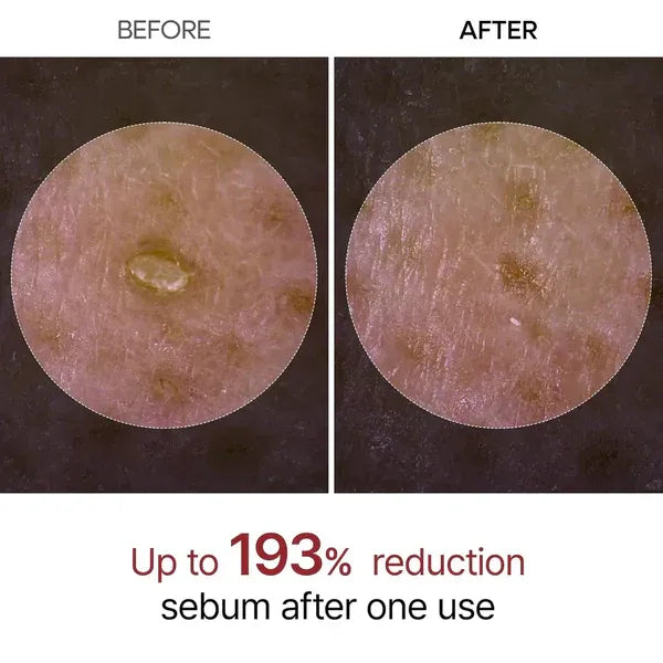 Melax Rice Peel Ampoule before and after result — Melax K-Beauty